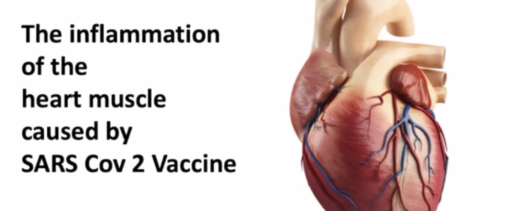Video – The Inflammation of the Heart Muscle Caused by SARS Cov 2 Vaccine